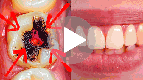 DentaBiome gum and enamel support demo