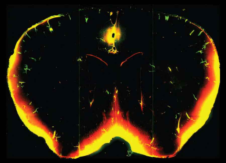 Middle age brain clearance declining
