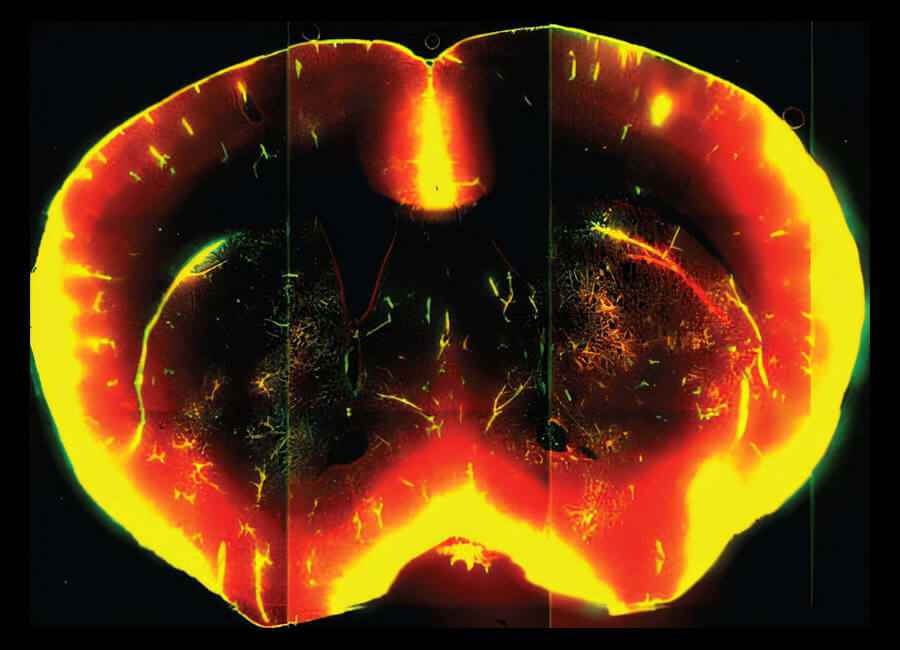 Young brain waste clearance active